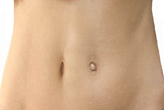 Why do some people have protruding navel while some have bowl shaped navel?