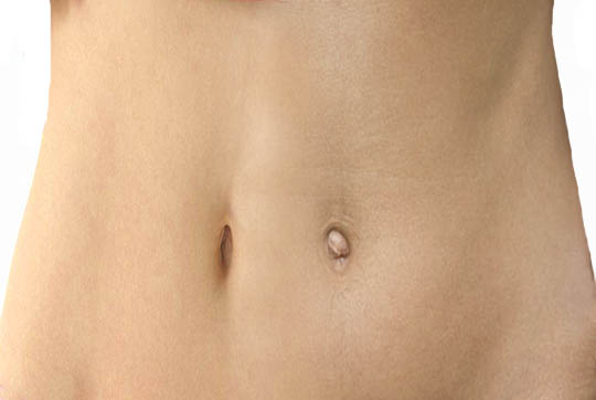 Why Do Some People Have Protruding Navel While Some Have Bowl Shaped Navel